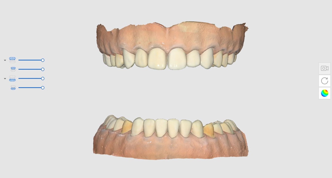 Medit Scan For Clinics V Impression Scan Medit Help Center