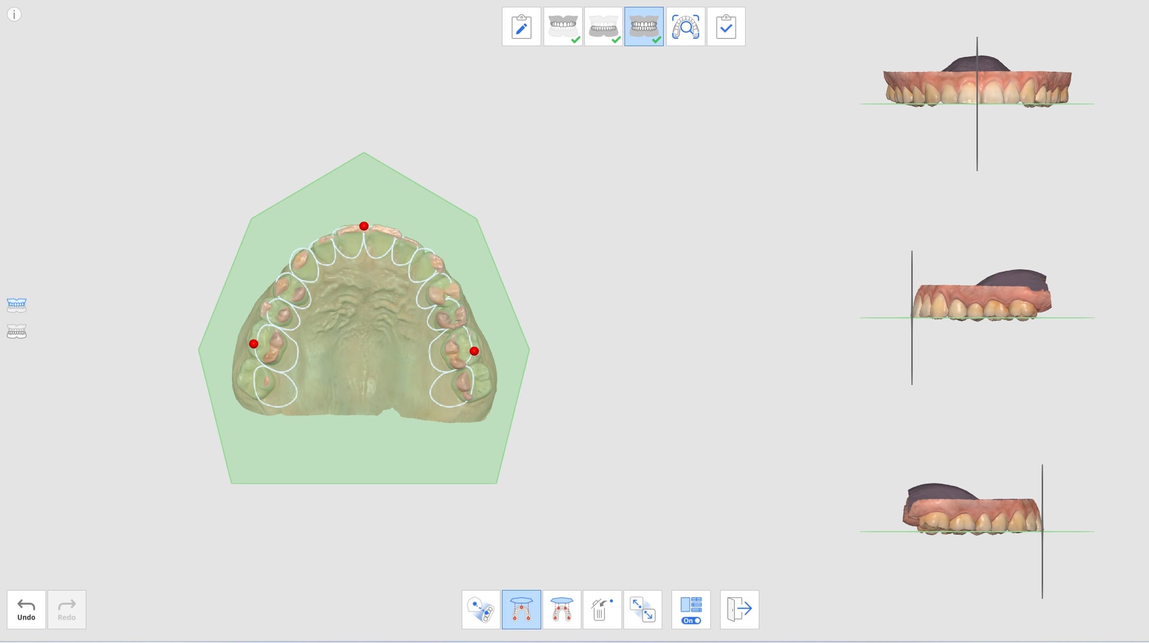 Medit Scan For Clinics V Occlusion Medit Help Center