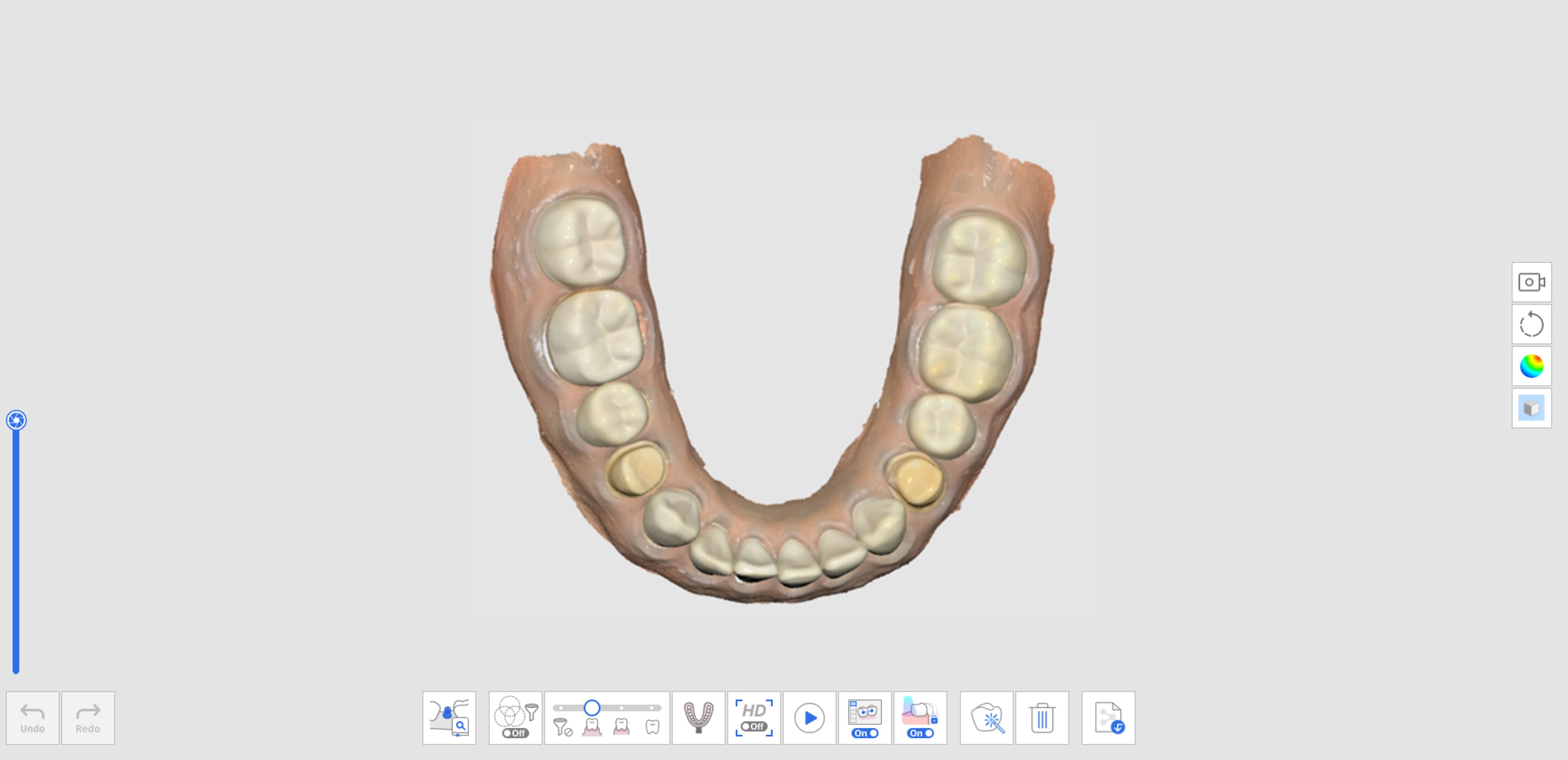 Medit Scan for Clinics v 1 12 0 印模扫描 Medit Help Center