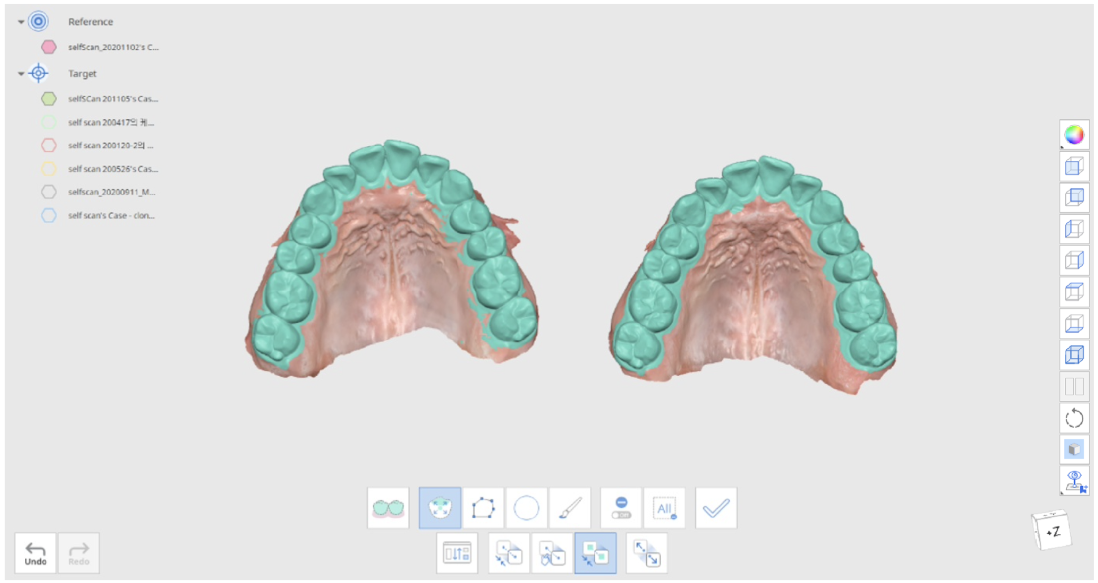 2.1_smart_teeth_selection.png