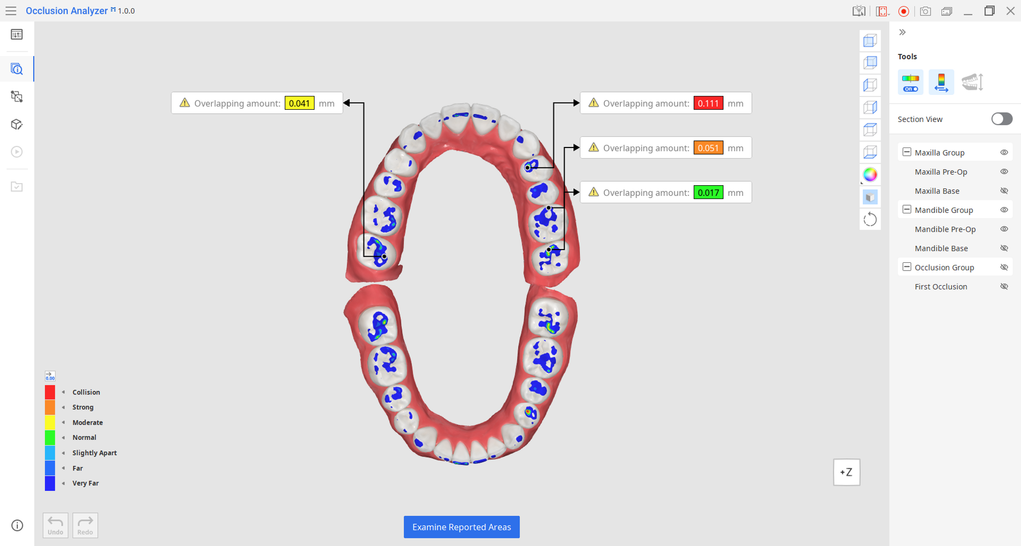 Auto Analysis Mode Medit Help Center