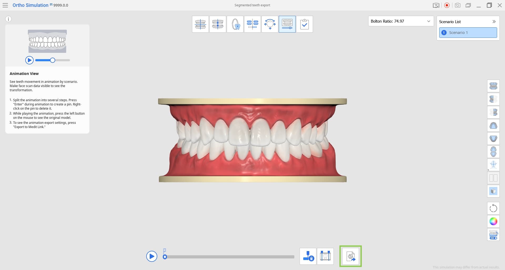 Medit-Ortoh-Simulation-1.jpg