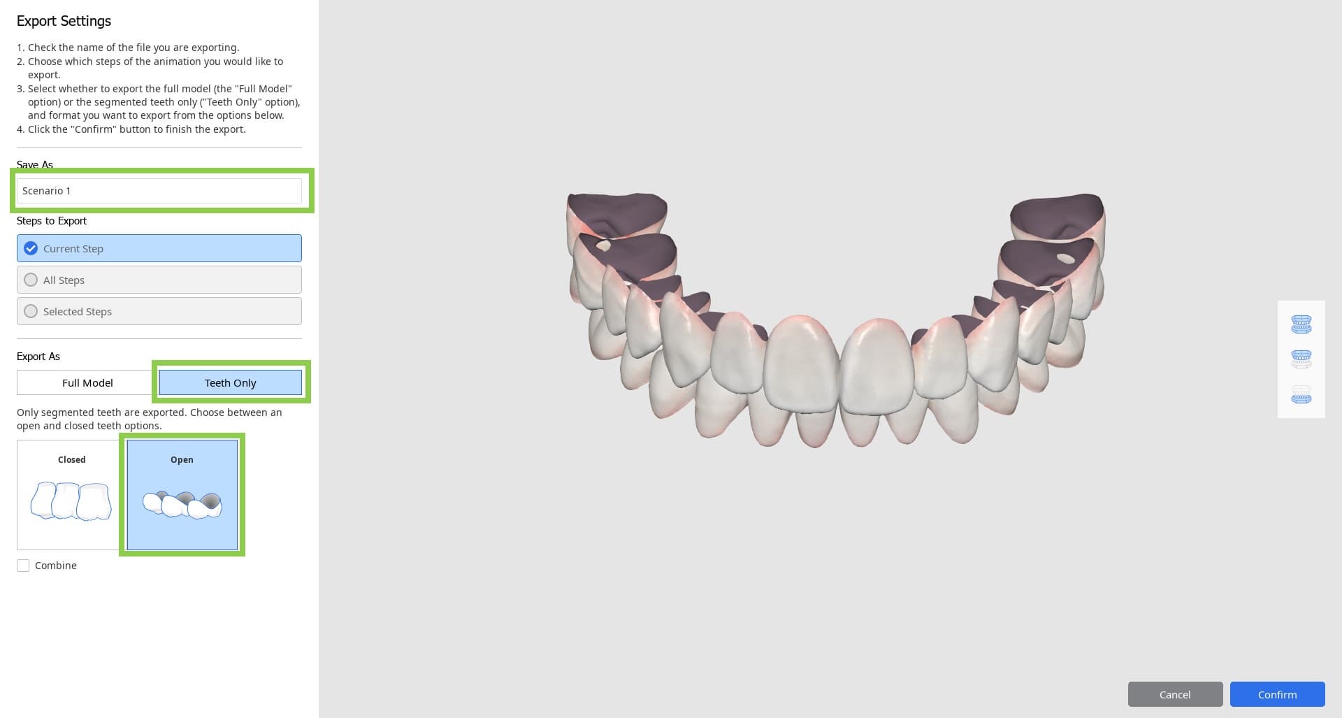 Medit-Ortoh-Simulation-2.jpg