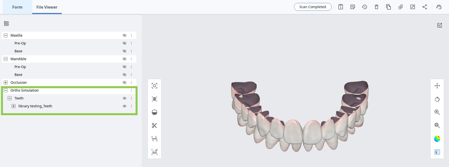 Medit-Ortoh-Simulation-4.jpg