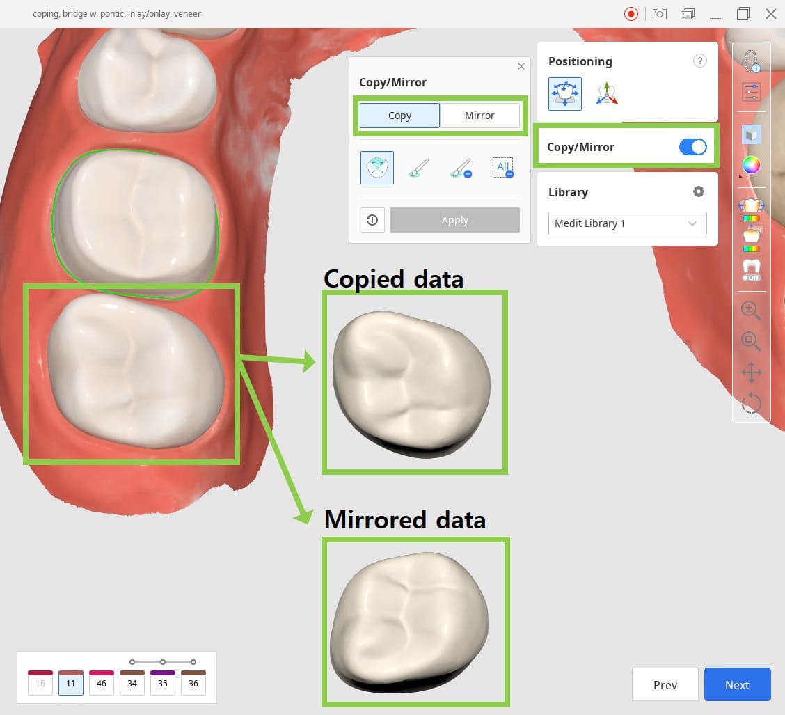 Tooth-Data-Arrangement-2.jpg