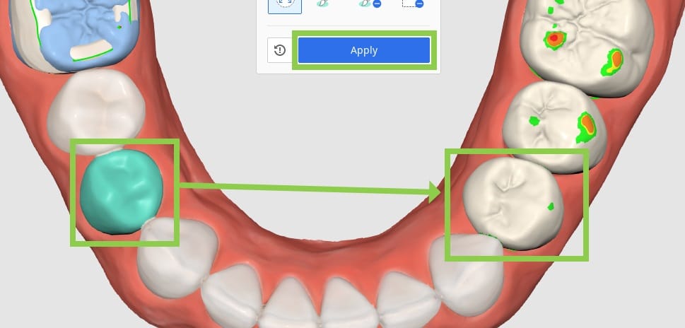 Tooth-Data-Arrangement-4.jpg