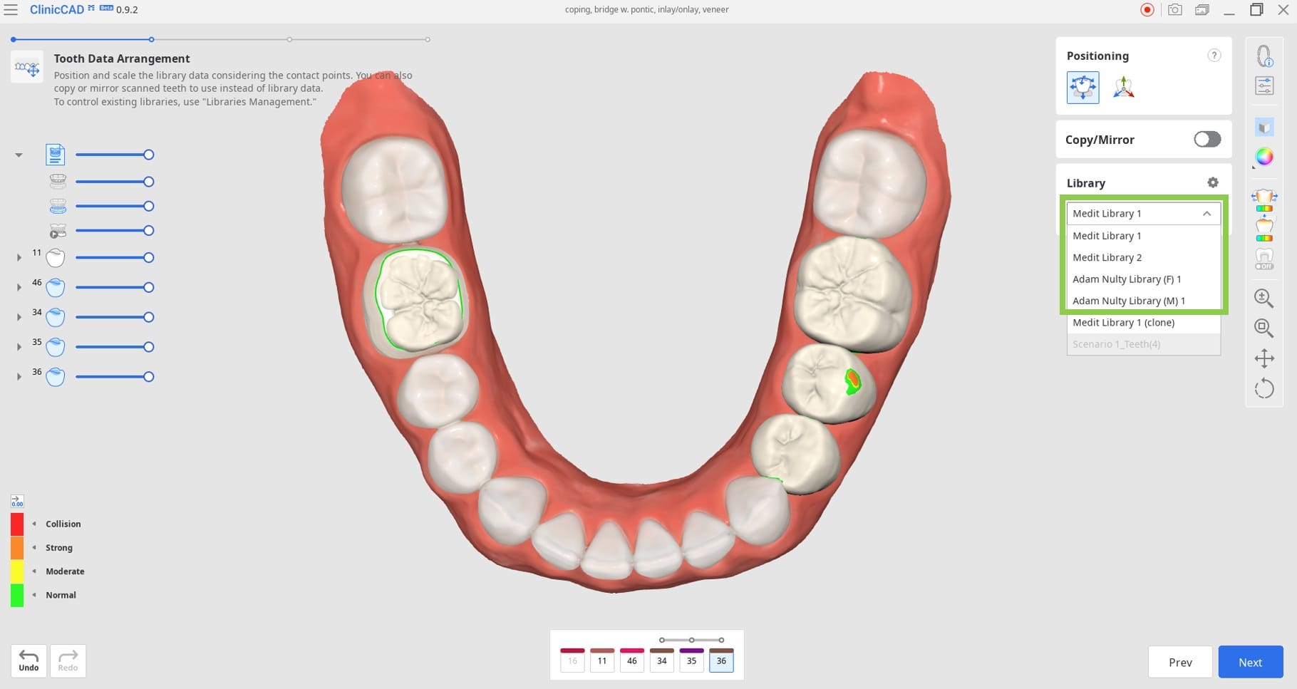Tooth-Data-Arrangement-1.jpg