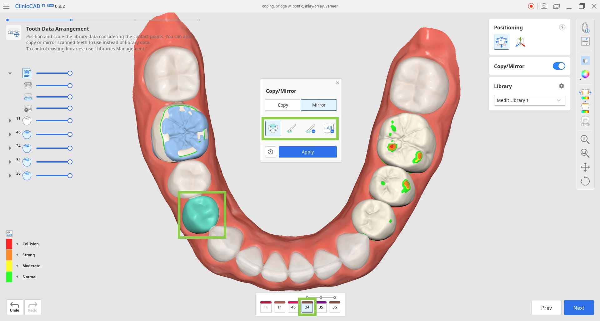 Tooth-Data-Arrangement-3.jpg