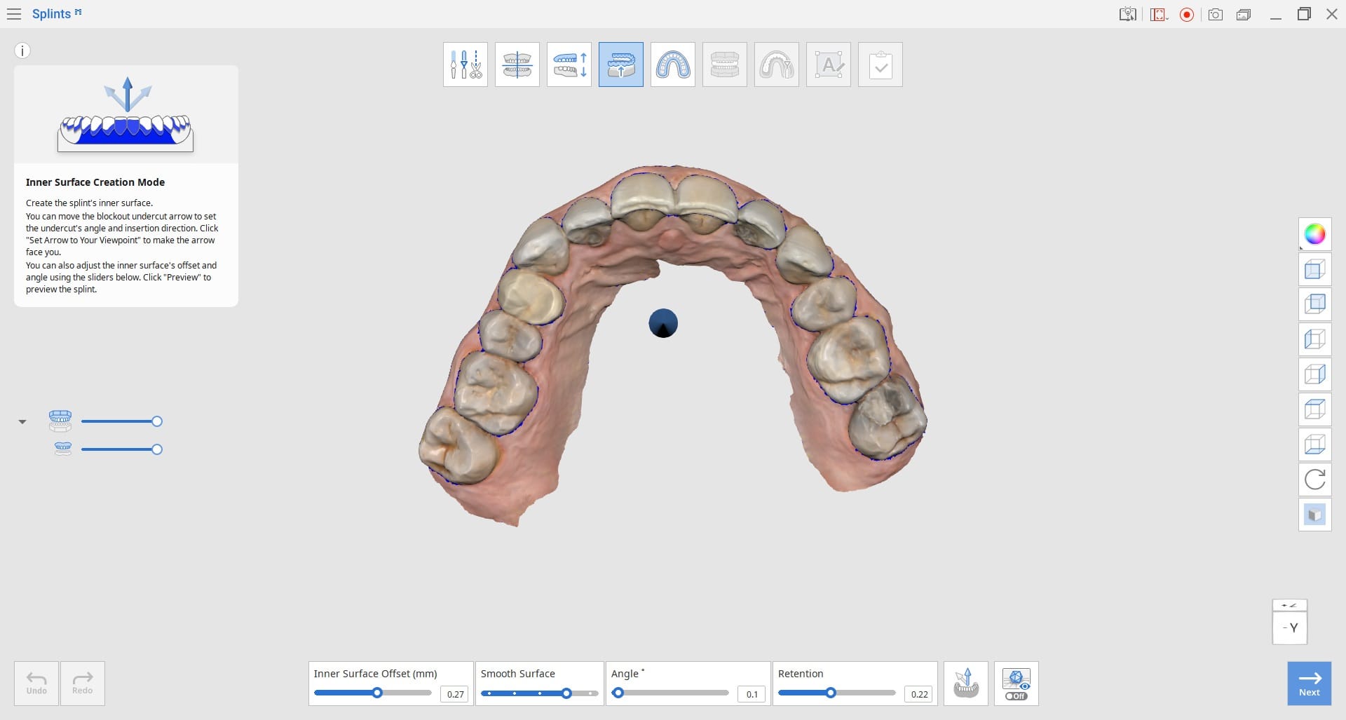 Inner-Surface-Creation-Mode-1.jpg