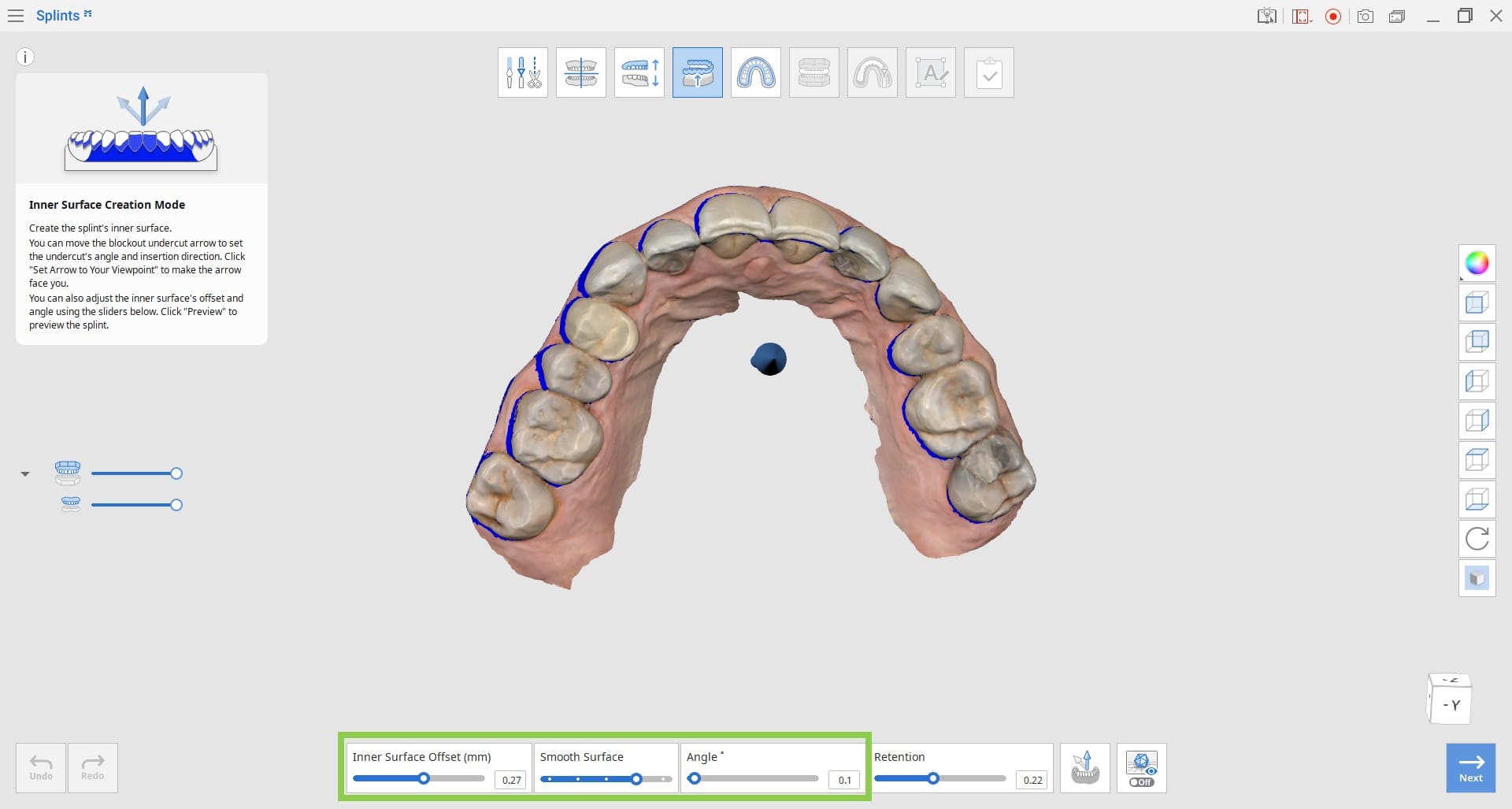 Inner-Surface-Creation-Mode-3.jpg