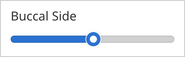 Buccal Side.png