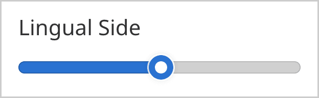Lingual-Side.png