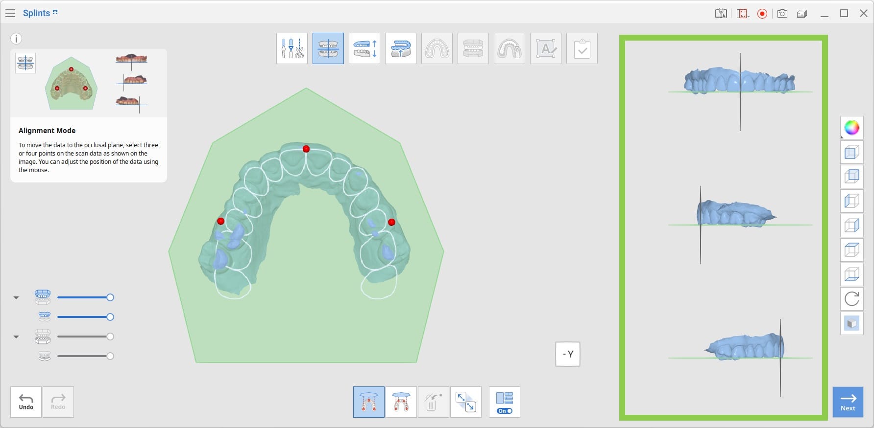 Alignment-Mode-4.jpg