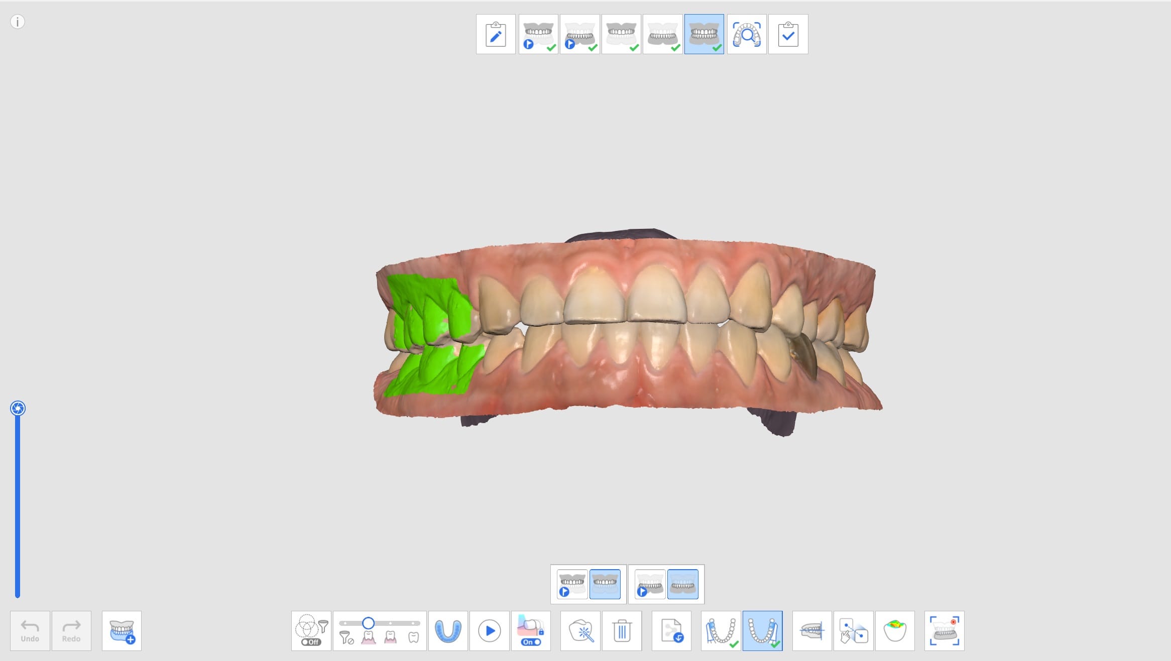 Medit Scan for Clinics v.1.12.0] Oclusión – Centro de Ayuda de Medit