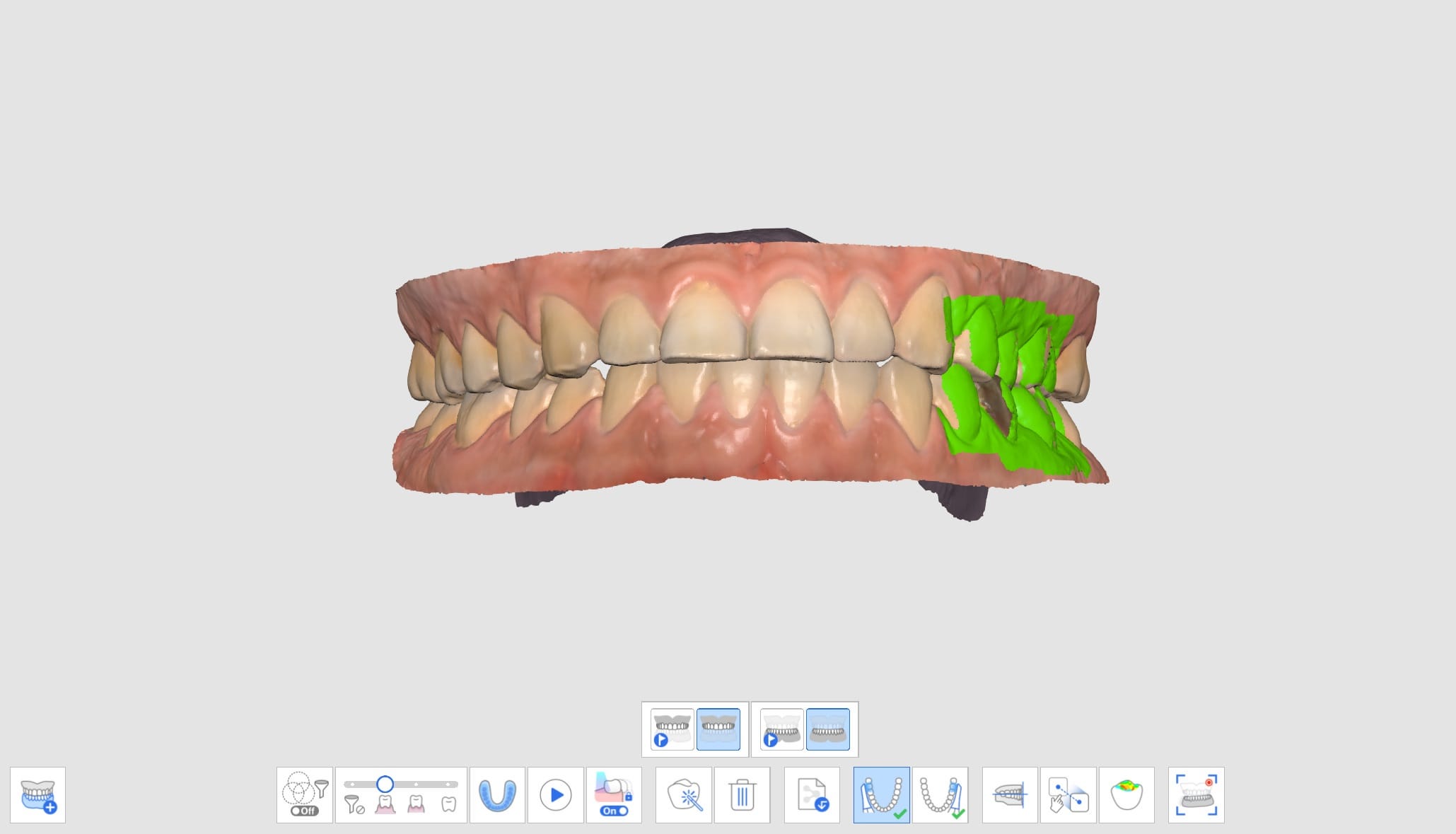 Medit Scan for Clinics v.1.11.0] 咬合 – Medit Help Center