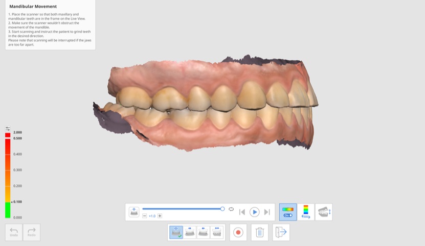 Medit Scan for Clinics v.1.11.0] 咬合 – Medit Help Center