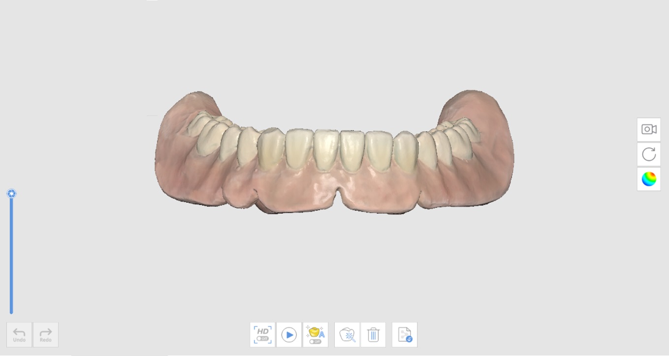 Denture Replica-2.jpg