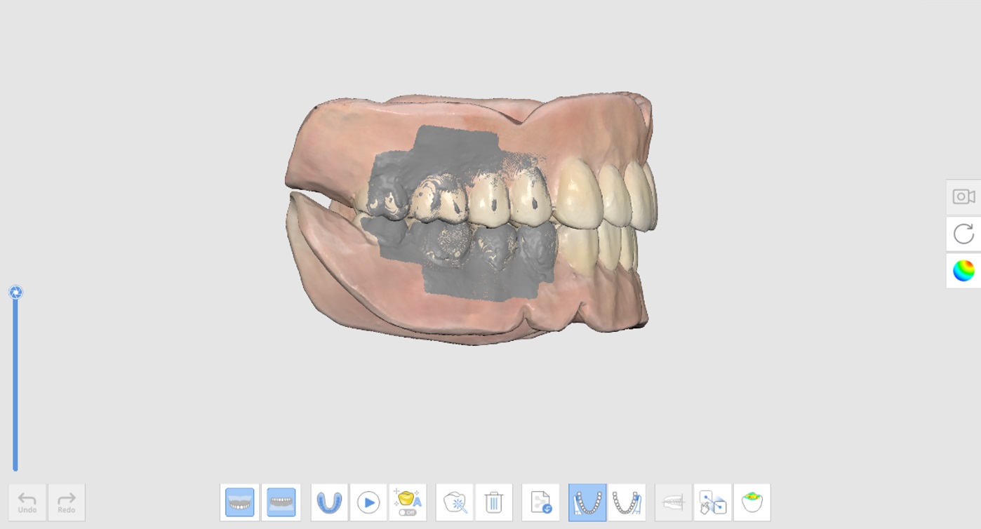 Denture Replica-3.jpg