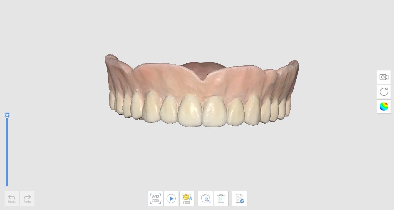 Denture Replica-1.jpg