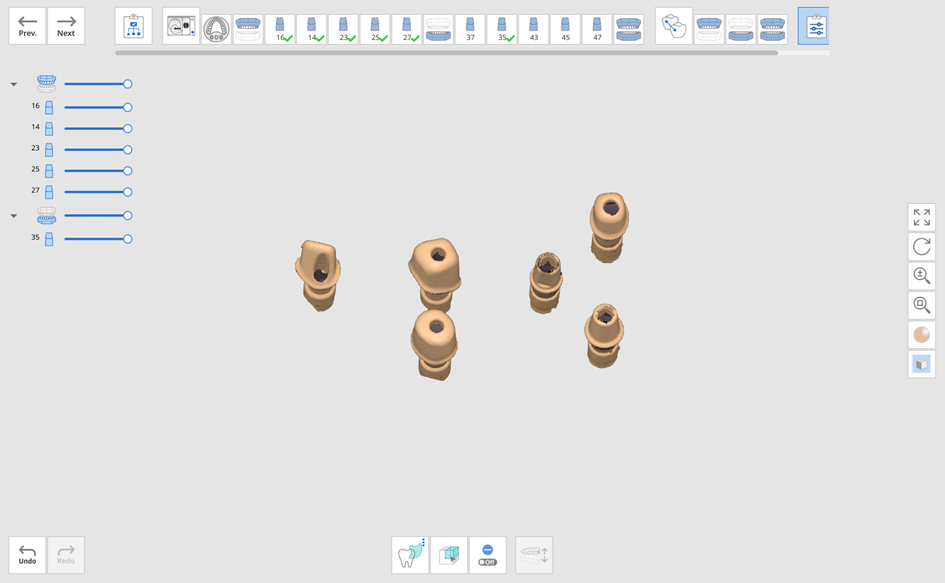 Fill Holes for Abutments 2.png