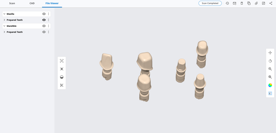 Fill Holes for Abutments 3.png