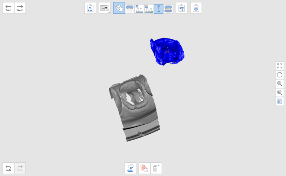 Post and Core 8.png