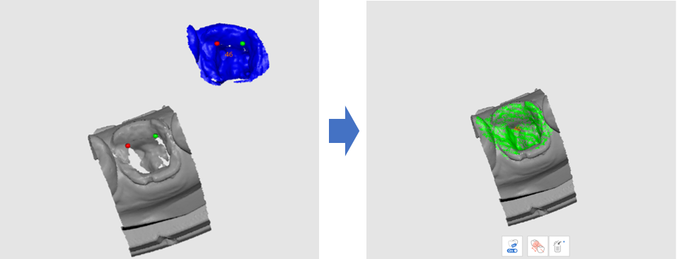 Post and Core 9.png