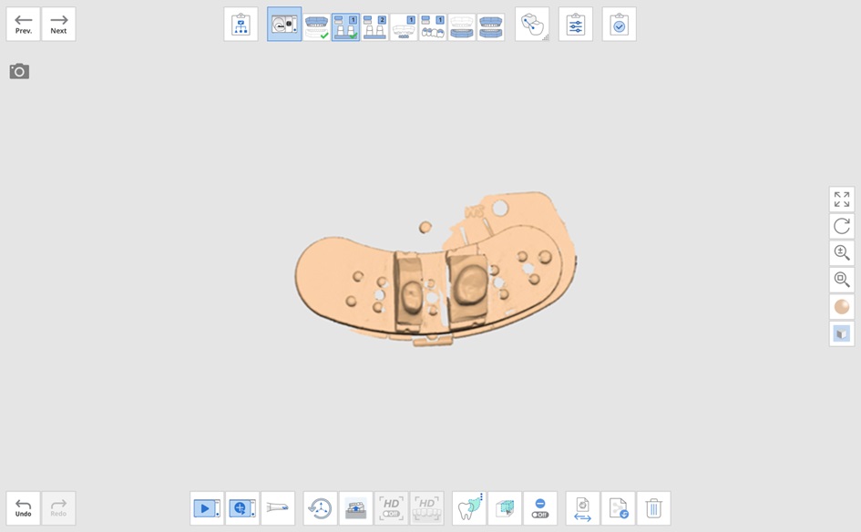 maxillary wax-up 4.jpg