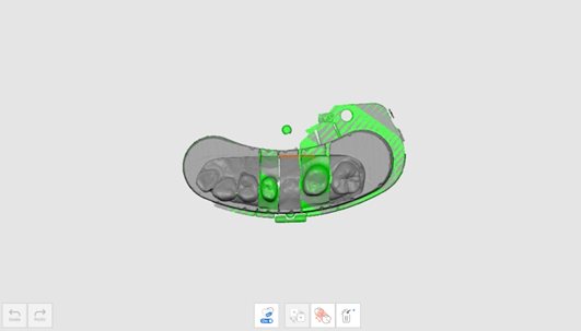 maxillary wax-up 8.png
