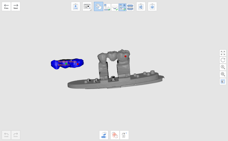 maxillary wax-up 10.png