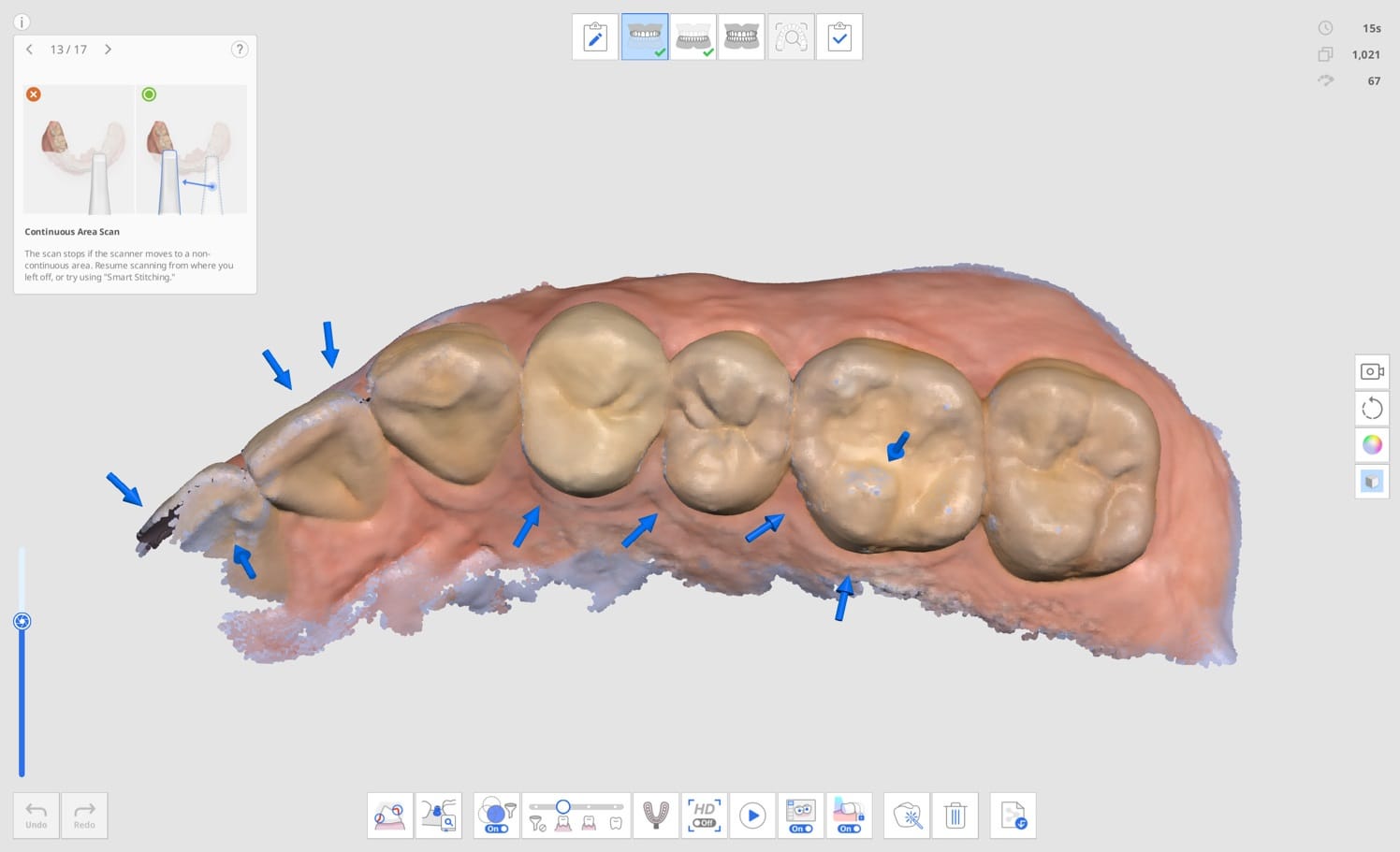 Medit Scan for Clinics v.1.12.0] Основы сканирования – Медит Справочный  центр