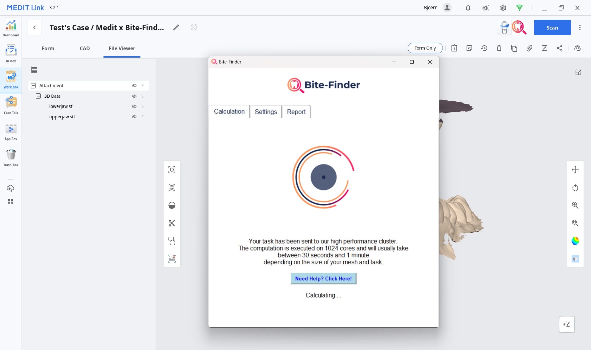 Bite Finder 5.jpg