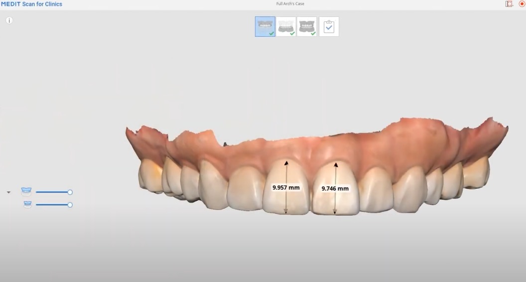 Case 2 1.jpg