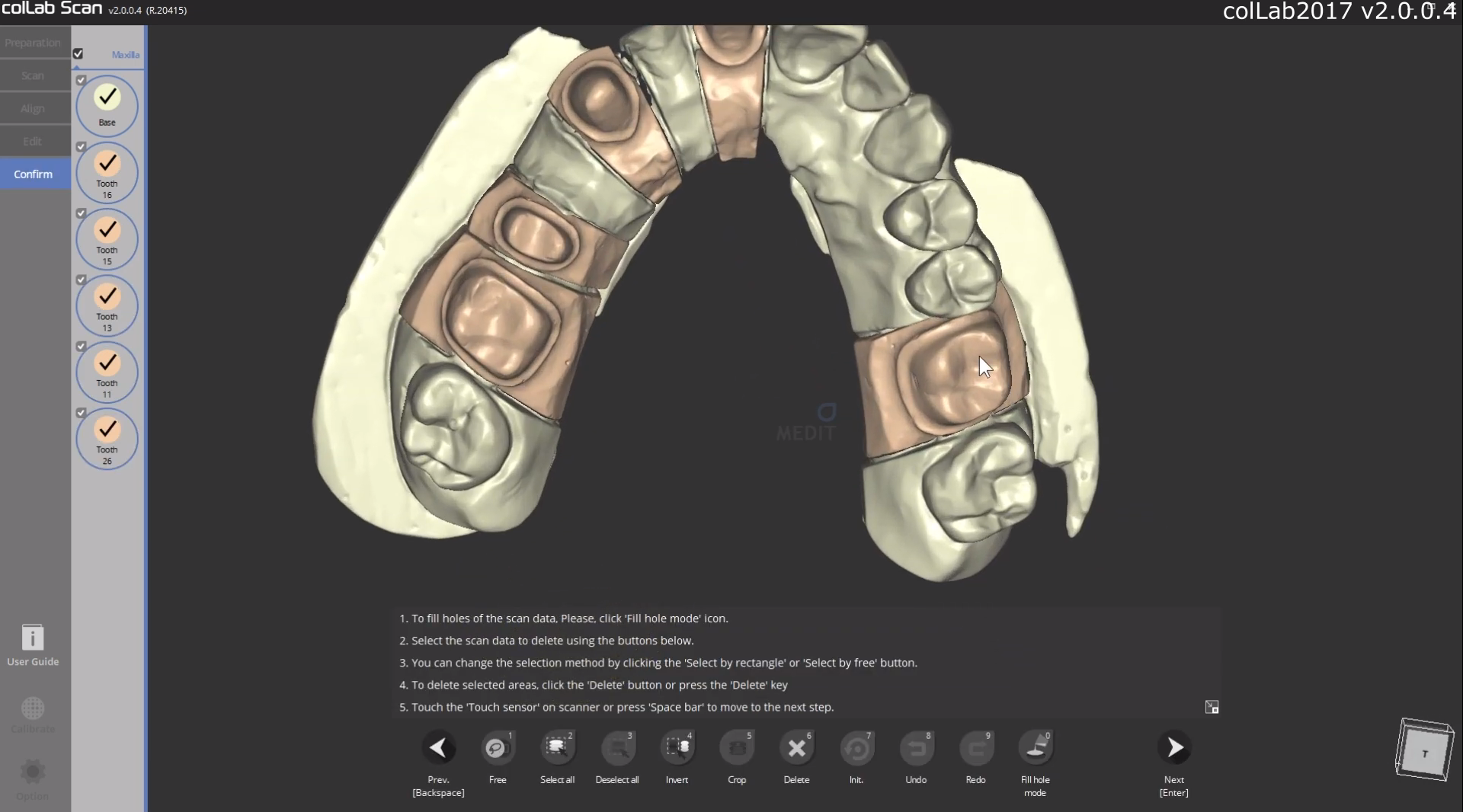 msert scan