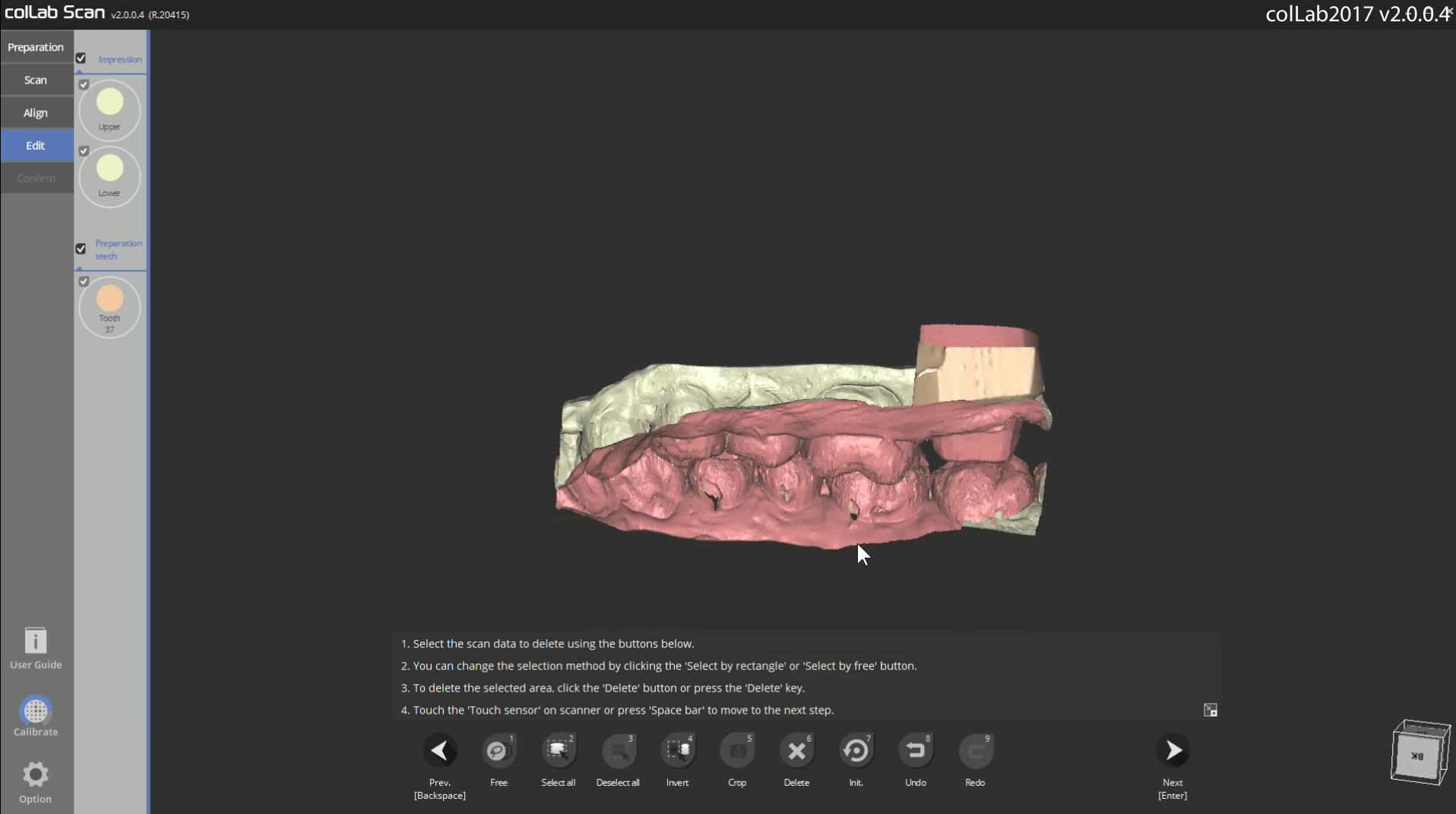 Scanning triple tray impression and plaster stump – Medit Help Center