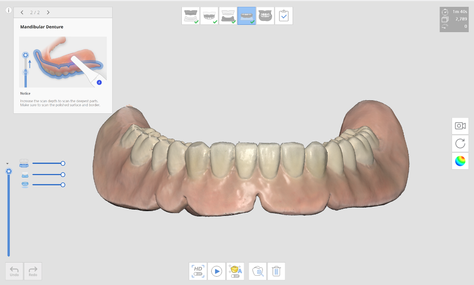 full_denture_scan_4.png