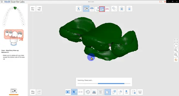 Crown Inner Scan on Model Scanner.webp