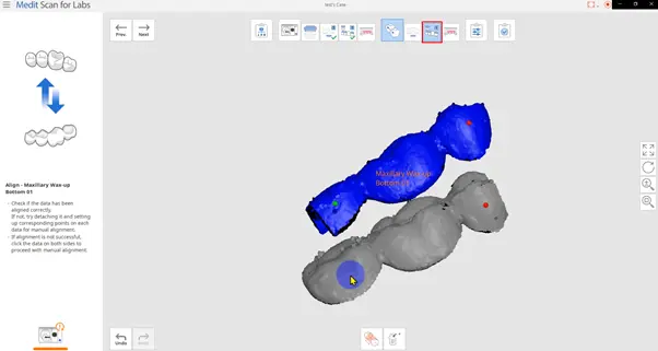 Matching of the inner and outer surfaces.webp