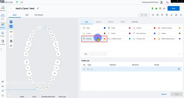 Select waxup when scanning crowns using a model scanner.webp