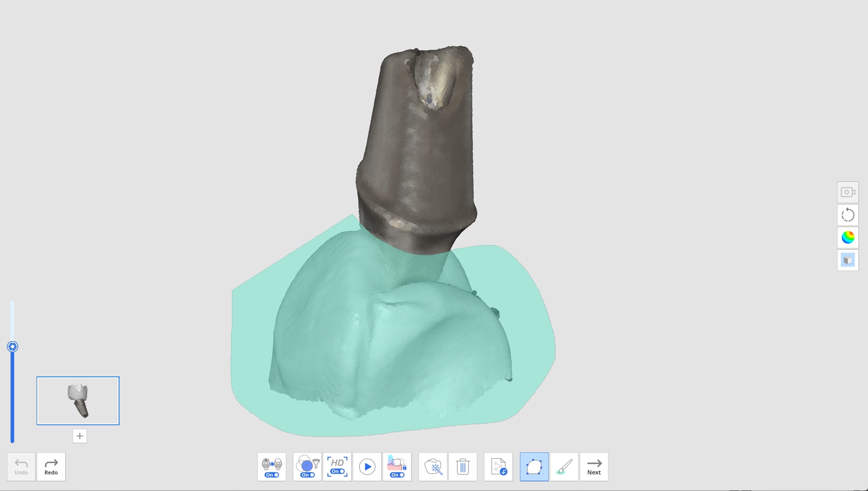 Register Abutments 4 2.jpg