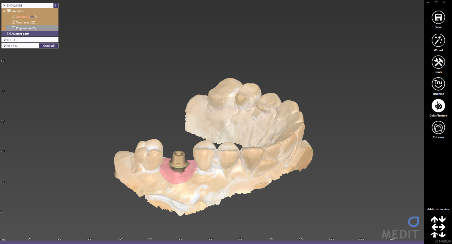 exocad.png