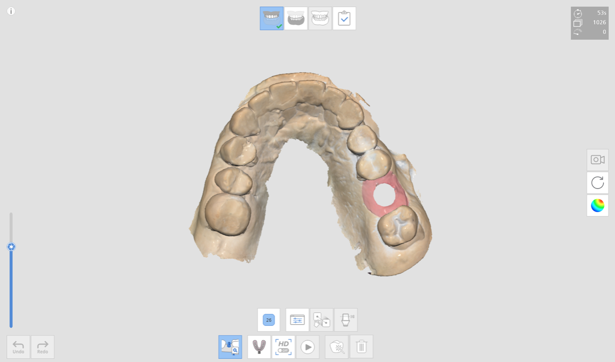 2._click_abutment.png
