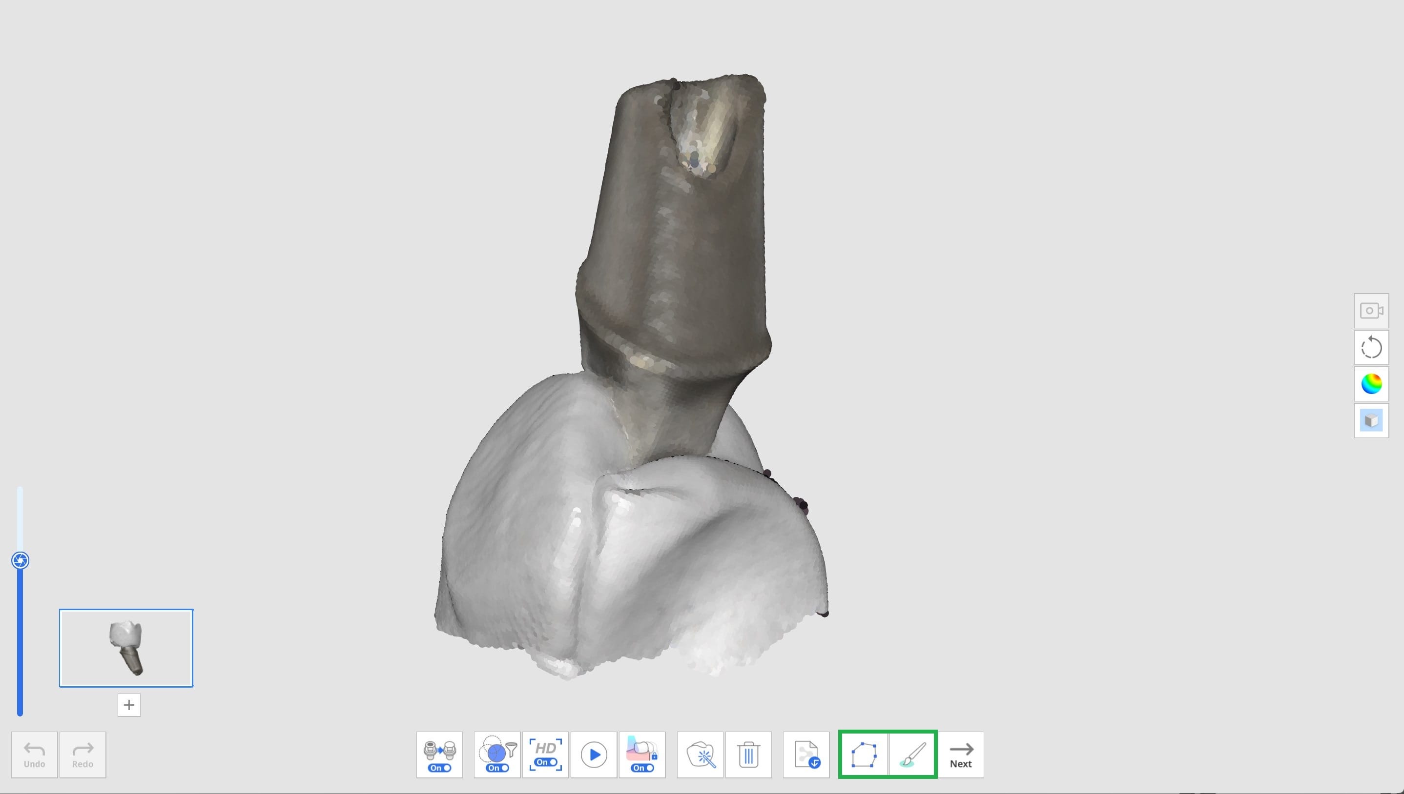 Register Abutments 4 1.jpg