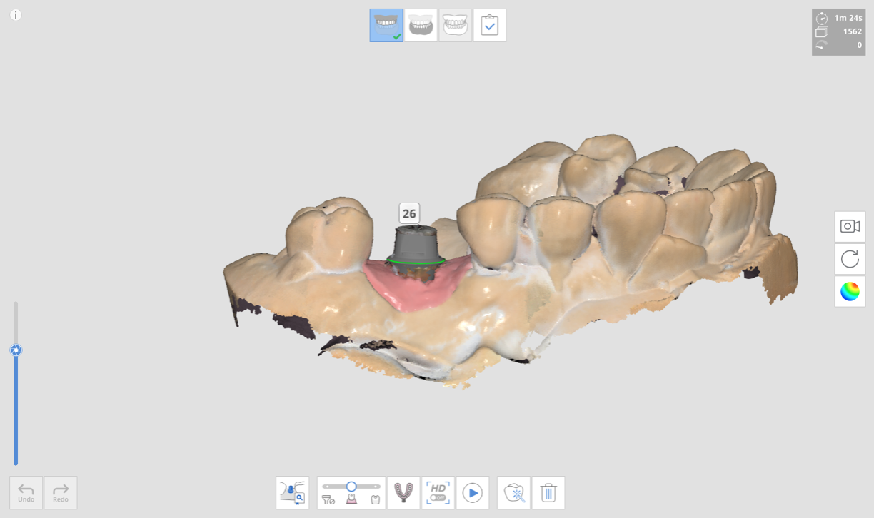 3._maxilla_scan_stage.png