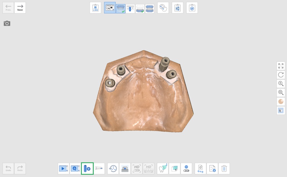 Add Another Scan Body-2.jpg