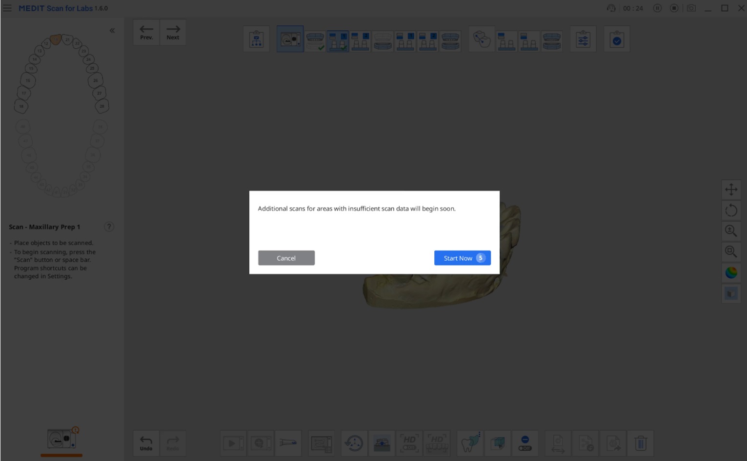 Automatic Additional Scan-1.jpg