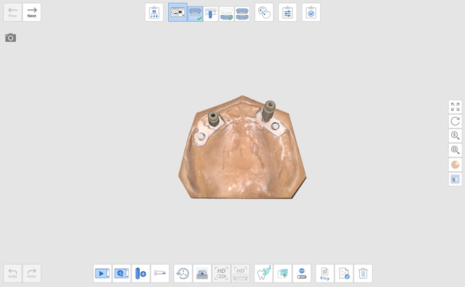 Add Another Scan Body-1.jpg