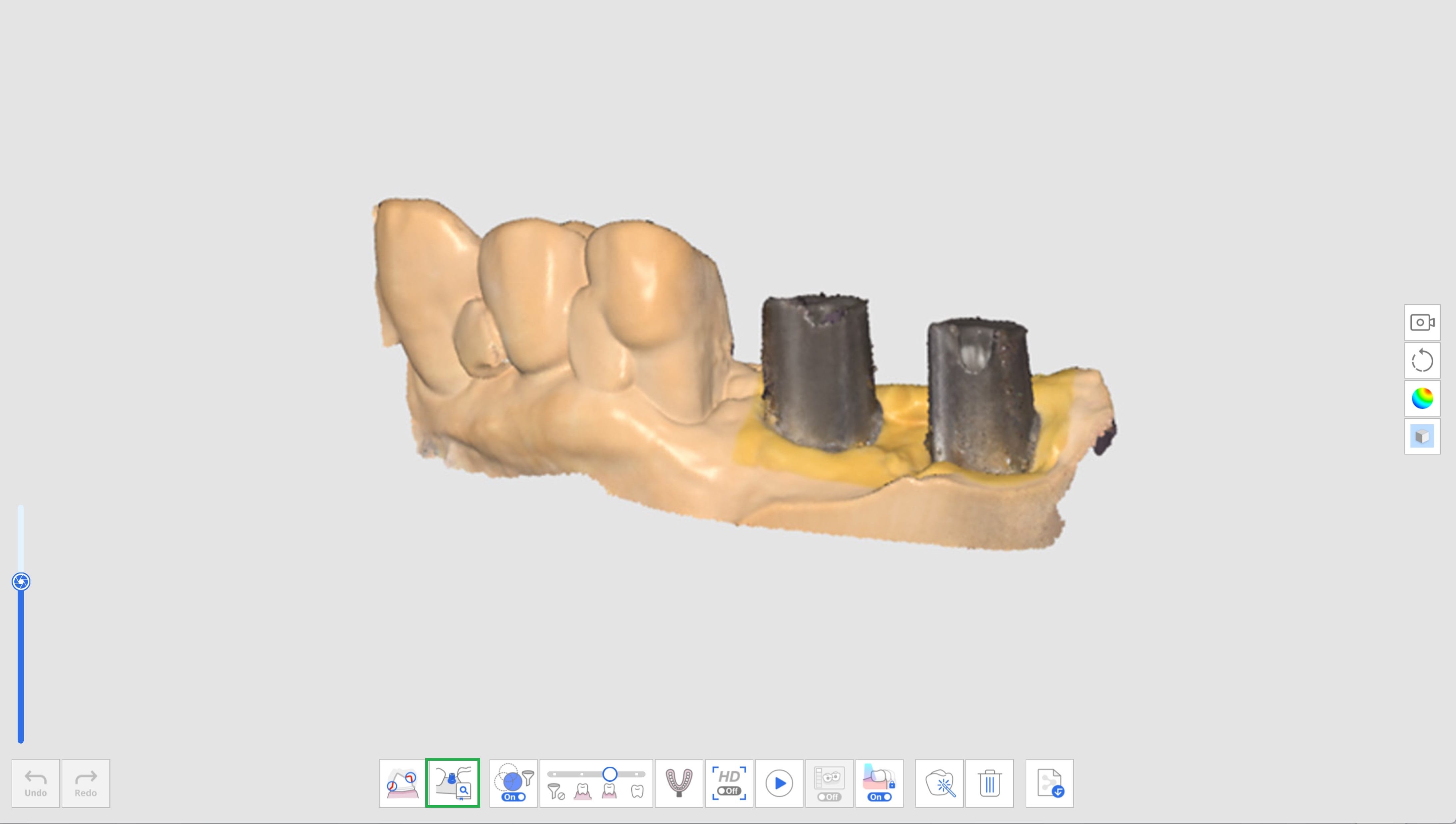 Assign Abutment Library 2.jpg