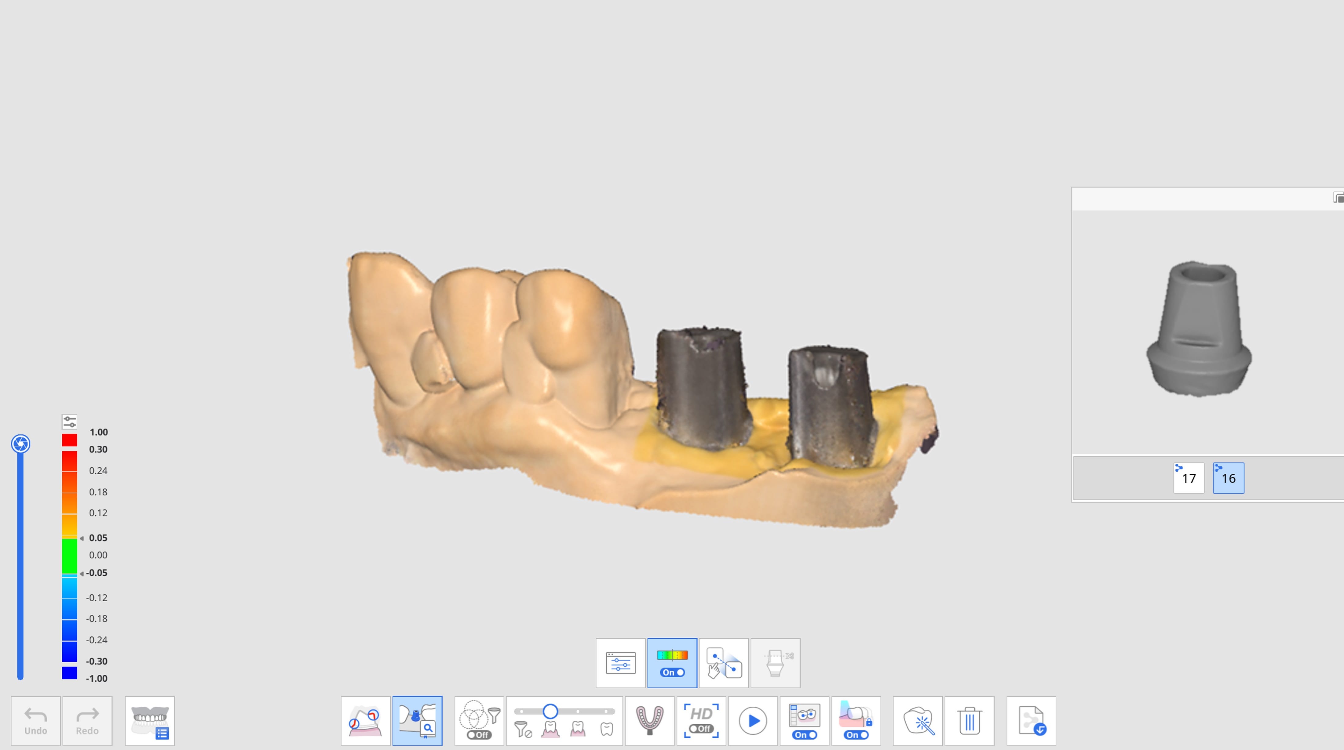 Align Abutment Library-1.jpg