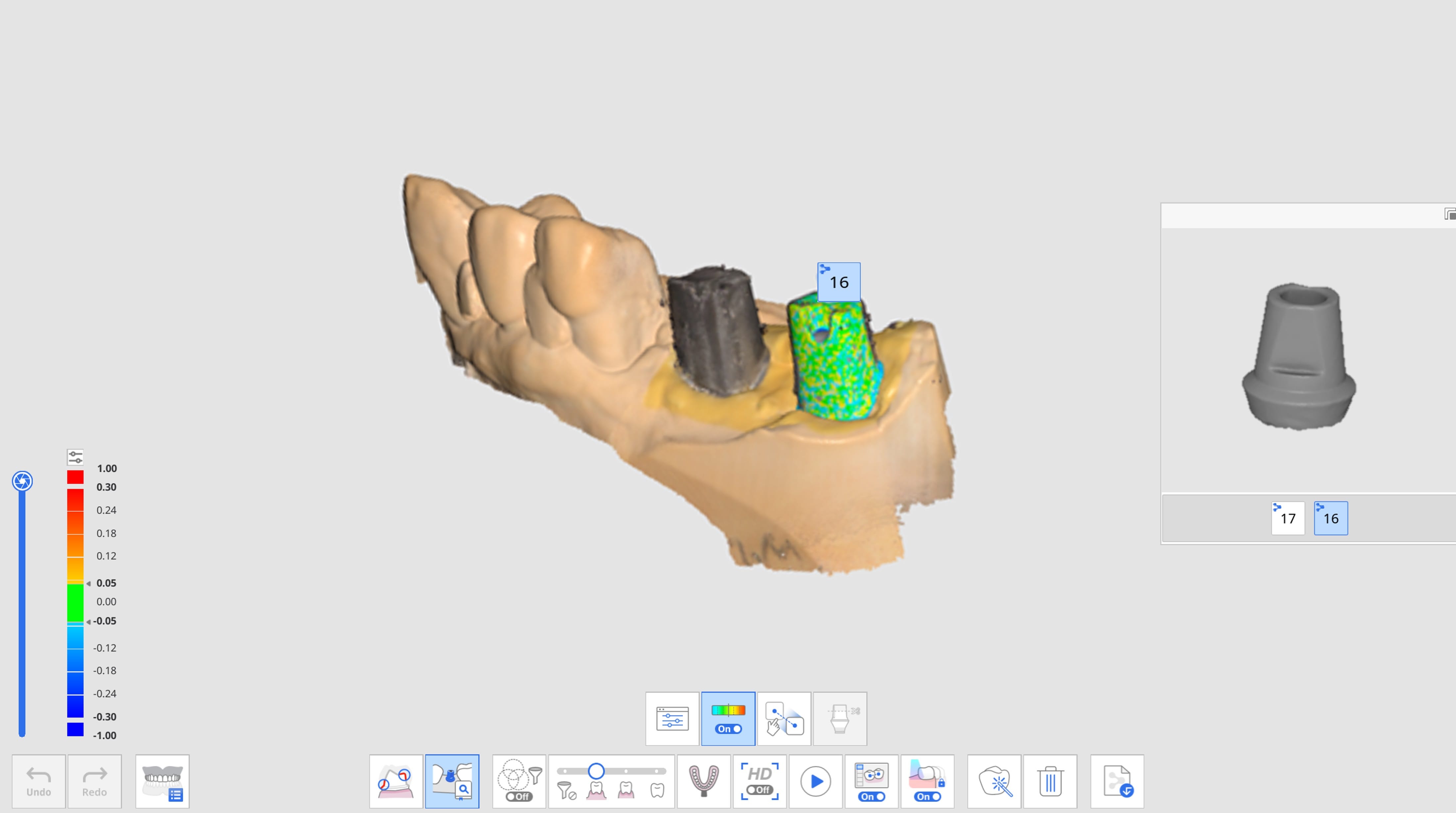 Align Abutment Library-2.jpg